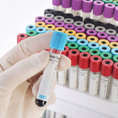 ভালো দাম সম্পূর্ণ রক্ত গণনা (CBC)-এর জন্য ভ্যাকুয়াম EDTA ব্লাড টিউব – উচ্চ গুণমান, সুরক্ষিত সীল অনলাইন